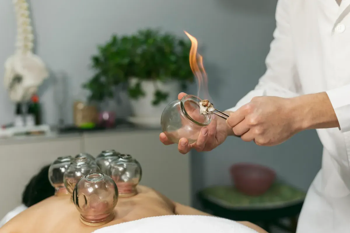 ครอบแก้ว บำบัดแบบจีน กรุงเทพ - Cupping Therapy Bangkok TCM Detox ดึงพิษ แก้ปวดเมื่อย